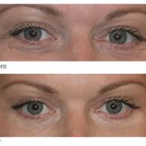 Dermelect Revitalite, Eyelid & Dark Circle Corrector, Full size/Brand New - Picture 4 of 7